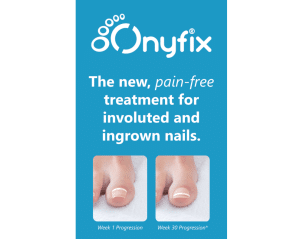 Onyfix Nail Bracing System For Ingrown Toenails Healthy Life Foot