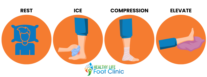 RICE: Rest, Ice, Compression, Elevate